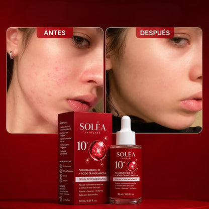 Solèa™ Dark Spot Correcting Serum