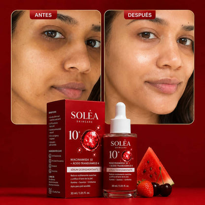 Solèa™ Dark Spot Correcting Serum