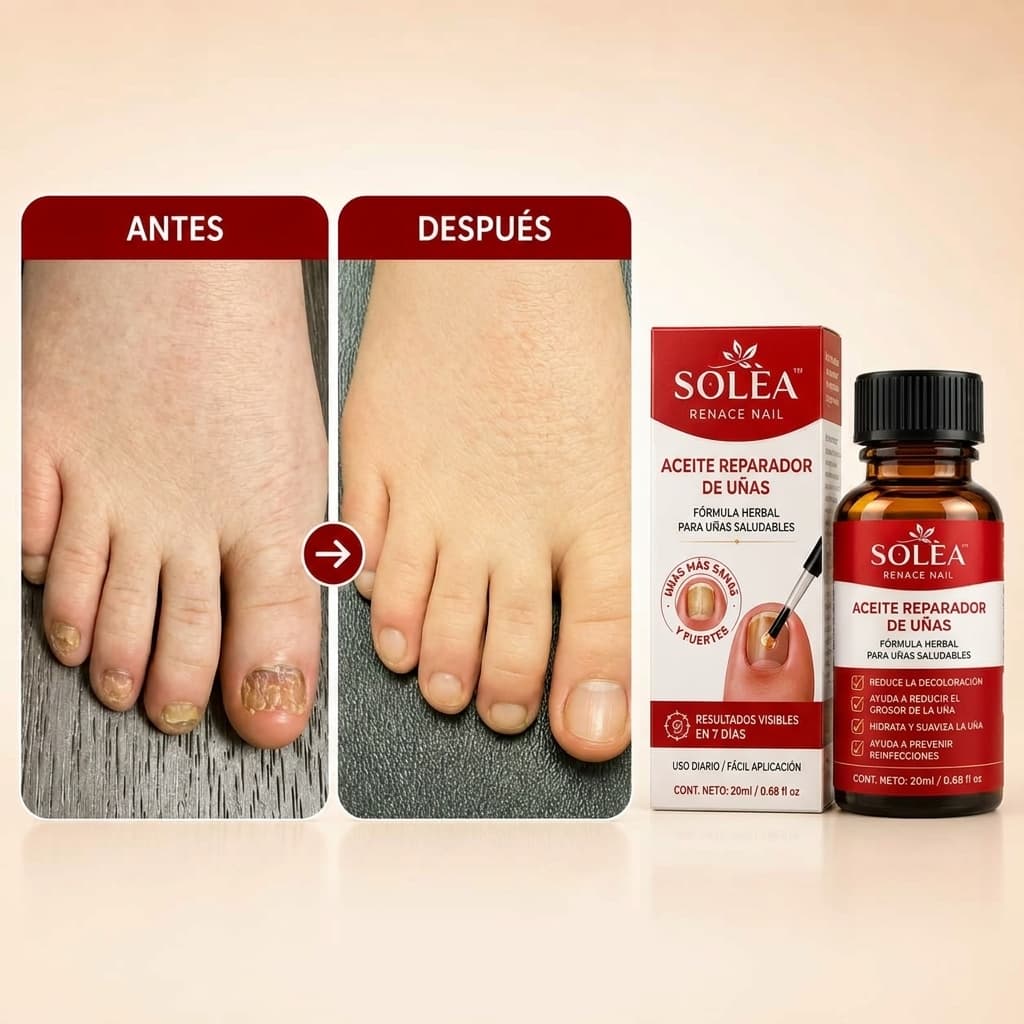 SOLÈA™ Unghie Rinascita