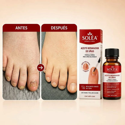 SOLÈA™ Unghie Rinascita