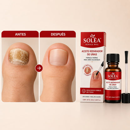 SOLÈA™ Unghie Rinascita